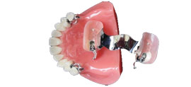 Metal Dentures Perth, WA Karratha, Port Hedland, Osborne Park
